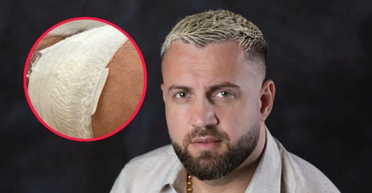 “Probleme me shendetin dhimbjet tĂ« mĂ«dha!” Operohet Luiz Ejlli ,deklarate te forte per STAFIN e spitalit… (FOTO)