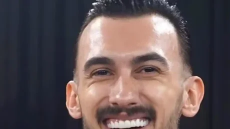 Lum komentesh për dhëmbët e tij të kuruar, ja si dukej Kristi Lamaj përpara këtij ndryshimi drastik