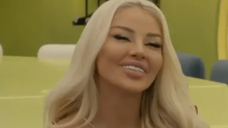 Me dhëmbë prej diamanti, zbulohet sa i kanë kushtuar banores së “Big Brother VIP Kosova”