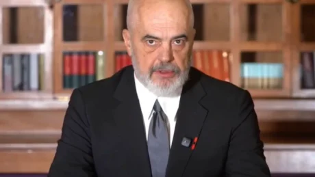 Rama flet hapur në podcast dhe bënë deklaratën e papritur ‘Unë vuaj nga…’