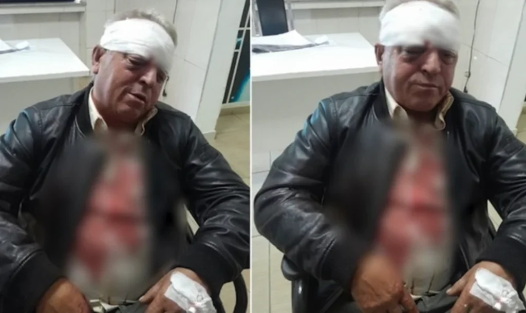 Tronditëse! Rrihet në mënyrë c’njerëzore punonjësi i Pastrimit, ja cfarë raportohet