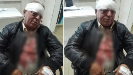 Tronditëse! Rrihet në mënyrë c’njerëzore punonjësi i Pastrimit, ja cfarë raportohet