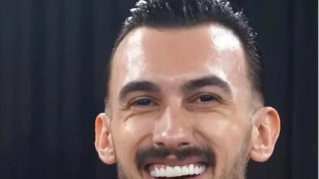 Lum komentesh për dhëmbët e tij të kuruar, ja si dukej Kristi Lamaj përpara këtij ndryshimi drastik